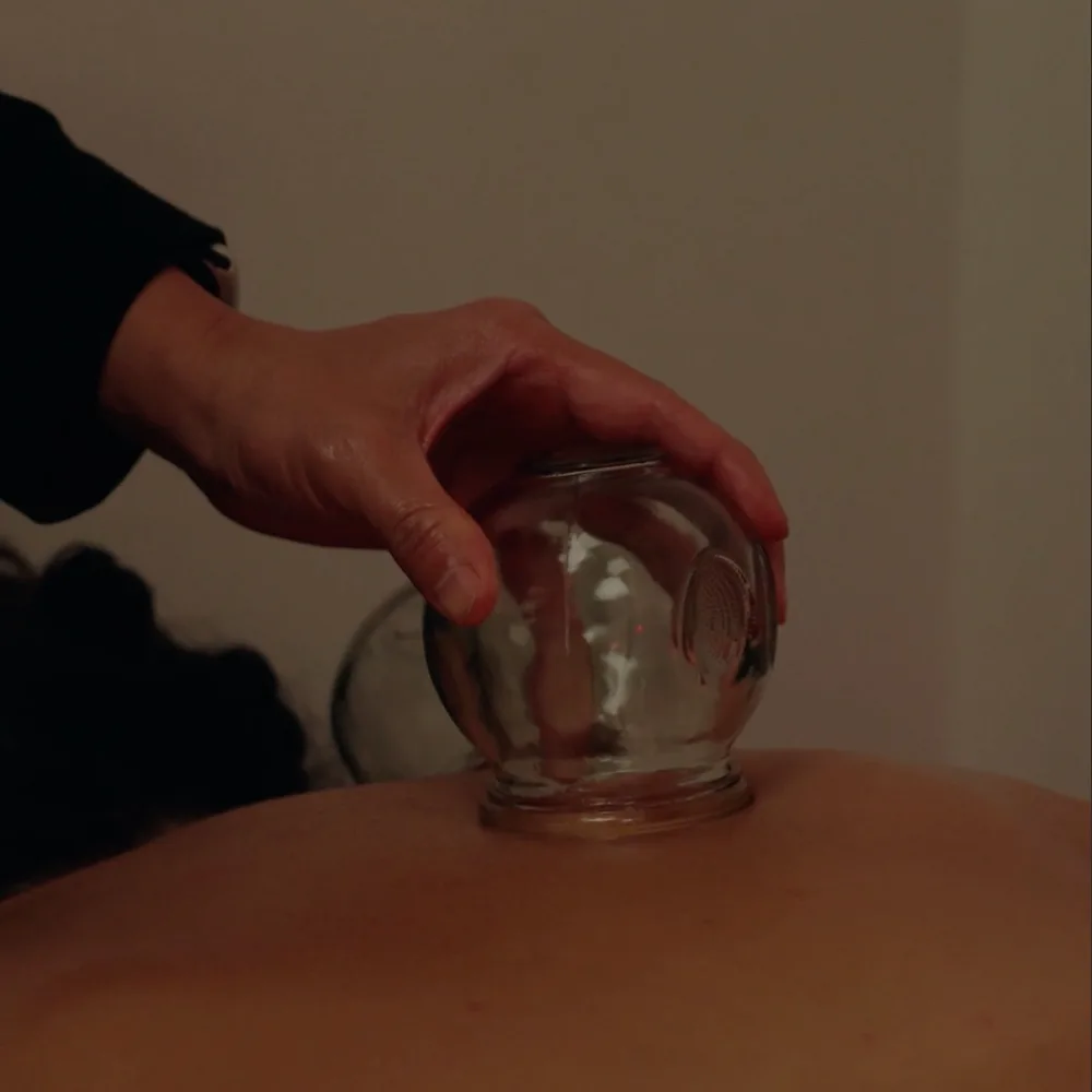 Cupping therapy